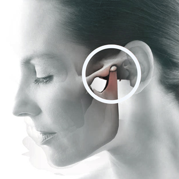 Dor Orofacial e Disfunção Temporomandibular – Desvende esse Mistério