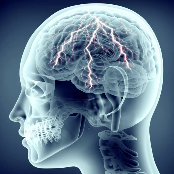 Epilepsia - Como agir frente a uma crise epiléptica?
