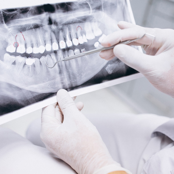 Odontologia Baseada em Evidências