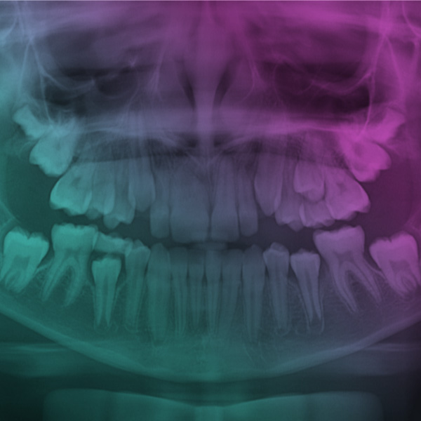 Exames radiográficos odontológicos na APS