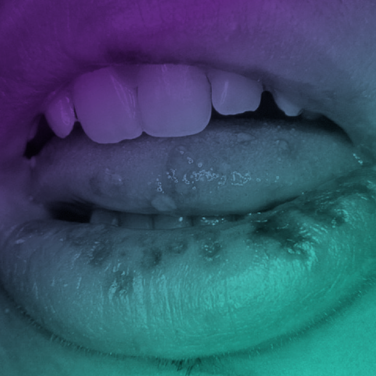 Manifestações bucais das Infecções Sexualmente Transmissíveis