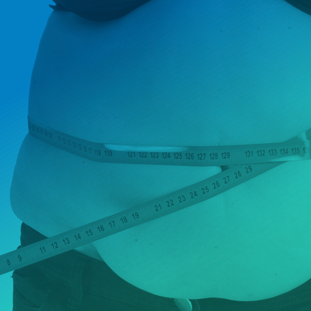 NOVA DATA: Acompanhamento psicológico no Pós operatório da Cirurgia Bariátrica